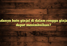 Adanya batu ginjal di dalam rongga ginjal dapat menimbulkan?